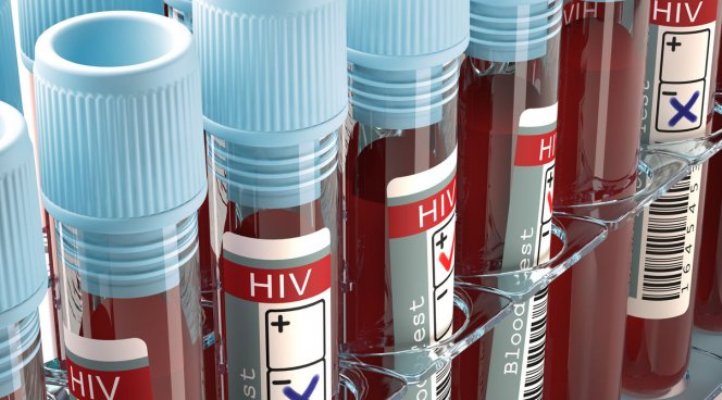 Заразиться ВИЧ от пациента на лекарствах невозможно